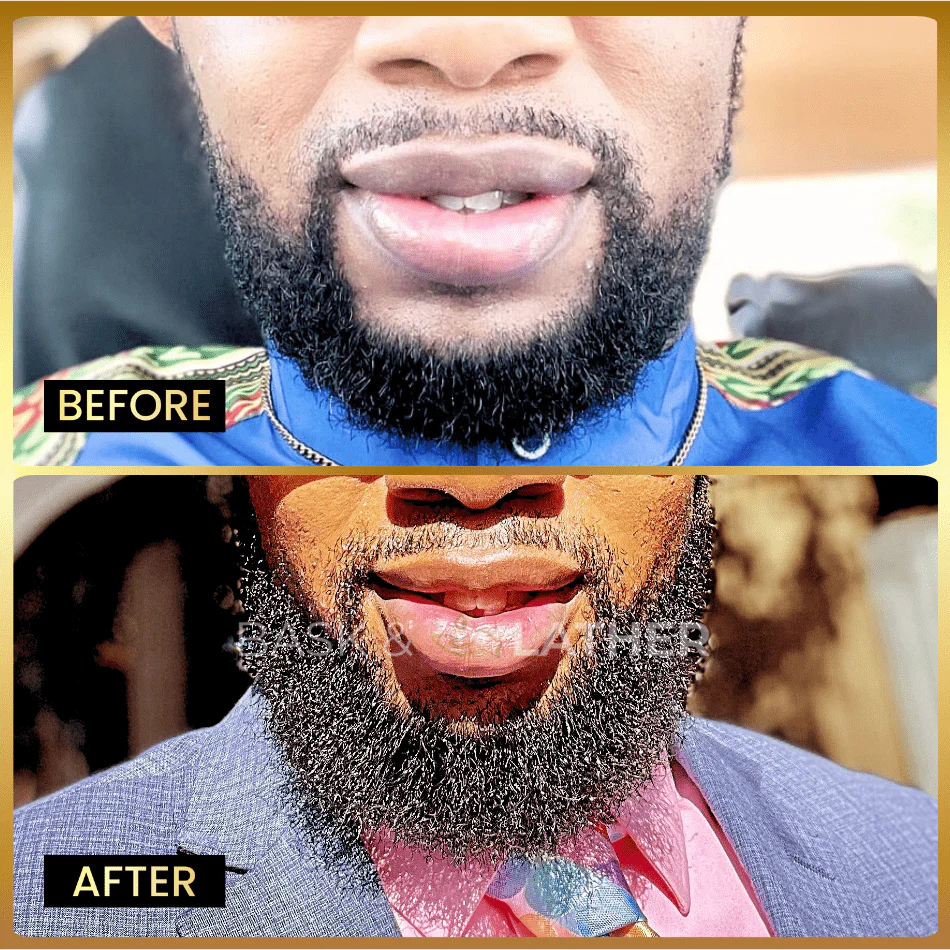 Beard Growth Magic (Beard Growth Oil) - Image 4